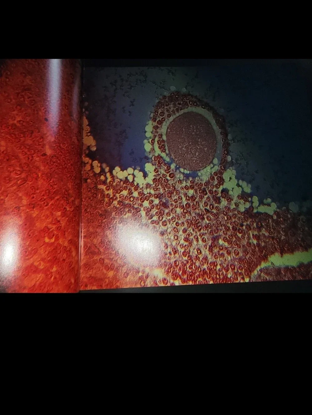 Life/Leben Lennart Nilsson Hardcover Picture Book Human Development Womb Anatomy
